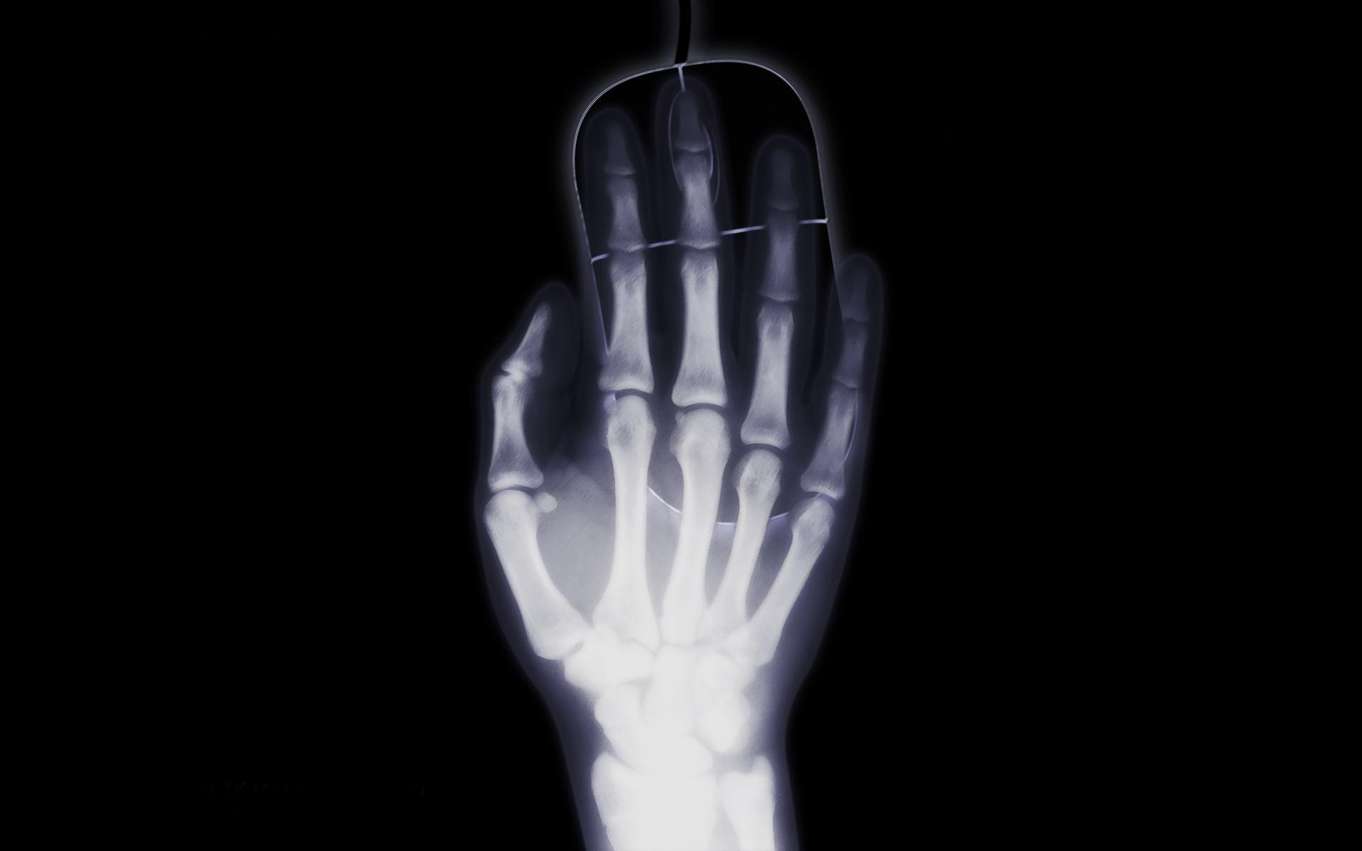 Xray of hand